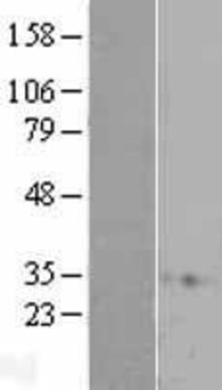 Novus Biologicals&trade;&nbsp;RAP1A Overexpression Lysate