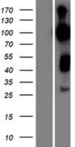 Novus Biologicals&trade;&nbsp;RAP1GAP2 Overexpression Lysate