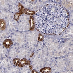 RAP1GAP Antibody, Novus Biologicals 25 &mu;L; Unlabeled:Antibodies, Polyclonal