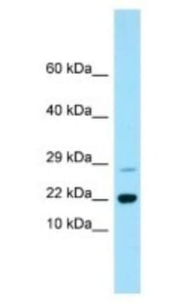 Rap2B Antibody, Novus Biologicals 100μL; Unlabeled:Antibodies, Polyclonal