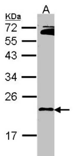 Rap2B Antibody, Novus Biologicals 0.1mL; Unlabeled:Antibodies, Polyclonal