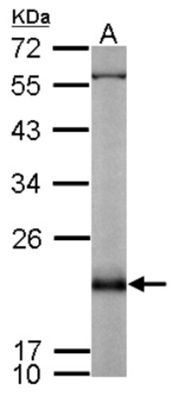 Rap2B Antibody, Novus Biologicals 0.1mL; Unlabeled:Antibodies, Polyclonal