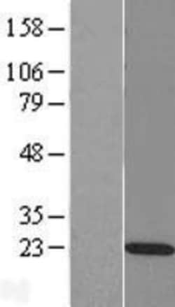 Novus Biologicals&trade;&nbsp;RAP2C Overexpression Lysate
