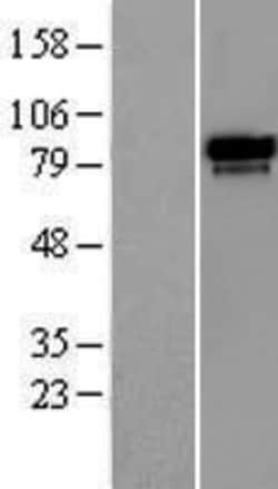 Novus Biologicals&trade;&nbsp;RAP80 Overexpression Lysate