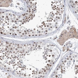 RAP80 Antibody, Novus Biologicals 25 &mu;L | Buy Online | Novus Biologicals | Fisher Scientific
