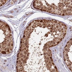 RAPGEF3 Antibody, Novus Biologicals 25 &mu;L, Unlabeled:Antibodies, Polyclonal