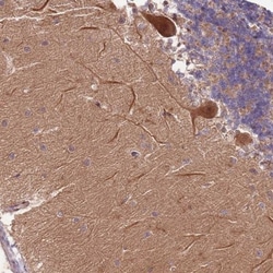 RAPGEF3 Antibody, Novus Biologicals:Antibodies:Primary Antibodies
