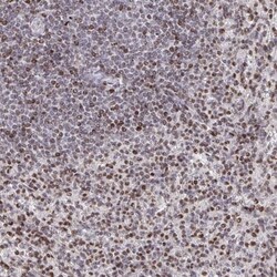 RAPGEF5 Antibody, Novus Biologicals 25 &mu;L, Unlabeled:Antibodies, Polyclonal