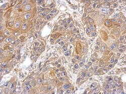 RAPGEFL1 Antibody, Novus Biologicals 0.1mL; Unlabeled:Antibodies, Polyclonal