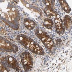 RAPH1 Antibody, Novus Biologicals:Antibodies:Primary Antibodies
