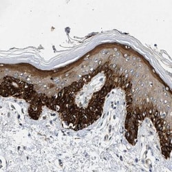 RAPH1 Antibody, Novus Biologicals 0.1mL; Unlabeled:Antibodies, Polyclonal