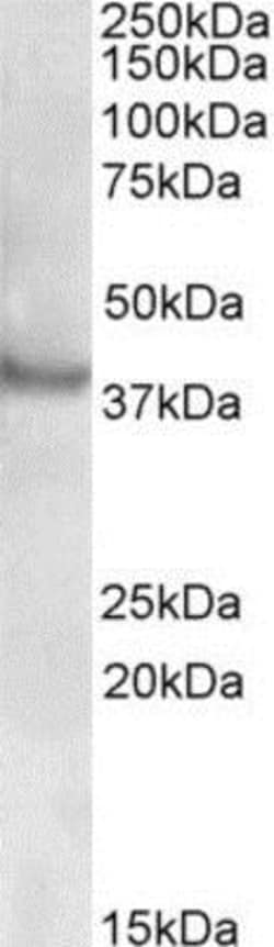 Rapsyn Antibody, Novus Biologicals 0.1mg; Unlabeled:Antibodies, Polyclonal
