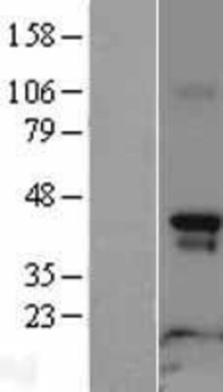 Novus Biologicals&trade;&nbsp;Rapsyn Overexpression Lysate