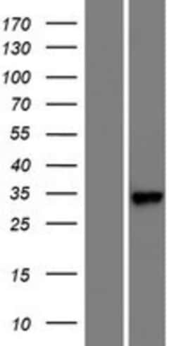 Novus Biologicals&trade;&nbsp;RARRES1 Overexpression Lysate