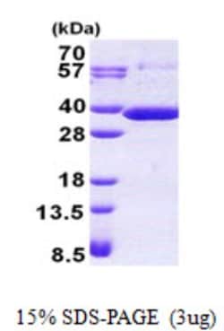 Novus Biologicals&trade;&nbsp;Recombinant Human RARRES1 His Protein
