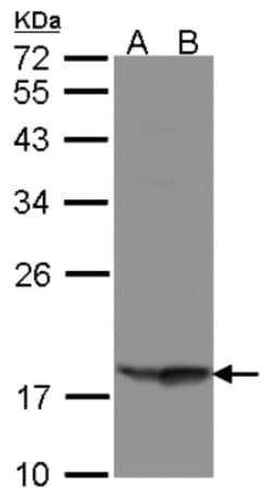 RARRES3 Antibody, Novus Biologicals 0.1mg; Unlabeled:Antibodies, Polyclonal