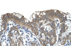 RARRES3 Antibody, Novus Biologicals 100&mu;L; Unlabeled:Antibodies, Polyclonal