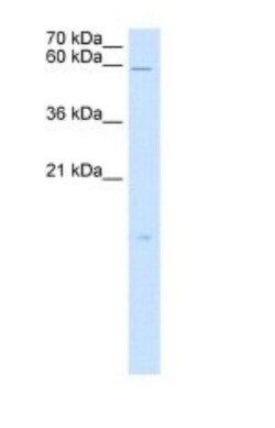 RARRES3 Antibody, Novus Biologicals 100&mu;L; Unlabeled:Antibodies, Polyclonal