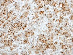 RASA3 Antibody, Novus Biologicals 0.1mL; Unlabeled:Antibodies, Polyclonal