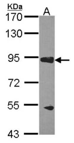 RASA3 Antibody, Novus Biologicals 0.1mg; Unlabeled:Antibodies, Polyclonal