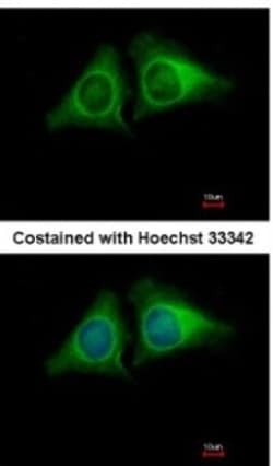 RASA4 Antibody, Novus Biologicals 0.1mL; Unlabeled:Antibodies, Polyclonal