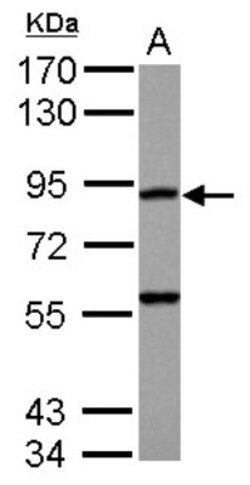 RASA4 Antibody, Novus Biologicals 0.1 mL | Buy Online | Novus Biologicals | Fisher Scientific