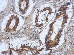 RASAL2 Antibody, Novus Biologicals 0.1mL; Unlabeled:Antibodies, Polyclonal
