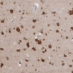 RASAL2 Antibody, Novus Biologicals:Antibodies:Primary Antibodies