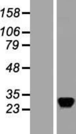 Novus Biologicals&trade;&nbsp;RASD2 Overexpression Lysate