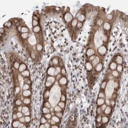 RASGEF1C Antibody, Novus Biologicals:Antibodies:Primary Antibodies