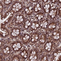 RASGRF1 Antibody, Novus Biologicals:Antibodies:Primary Antibodies