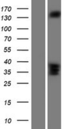 Novus Biologicals&trade;&nbsp;RASGRF2 Overexpression Lysate