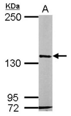 RASGRF2 Antibody, Novus Biologicals 0.1mL; Unlabeled:Antibodies, Polyclonal