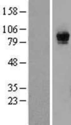 Novus Biologicals&trade;&nbsp;Rasgrp1 Overexpression Lysate