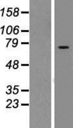 Novus Biologicals&trade;&nbsp;RASGRP2 Overexpression Lysate