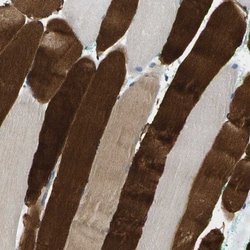 FPRP/PTGFRN Antibody, Novus Biologicals:Antibodies:Primary Antibodies