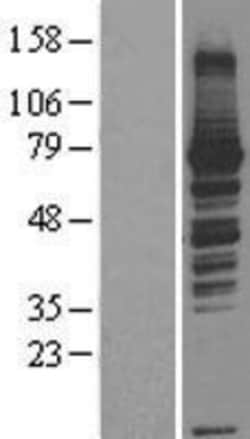 Novus Biologicals&trade;&nbsp;RASGRP3 Overexpression Lysate