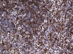 RASGRP3 Antibody (OTI2C11), Novus Biologicals 0.1mL; Unlabeled:Antibodies,