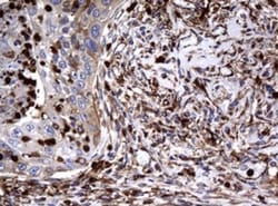 RASGRP3 Antibody (OTI2C11), Novus Biologicals 0.1mL; Unlabeled:Antibodies,