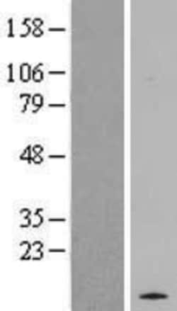 Novus Biologicals&trade;&nbsp;RASL10A Overexpression Lysate