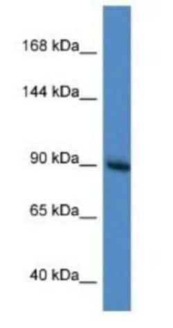 Ras-GAP Antibody, Novus Biologicals 100&mu;L; Unlabeled:Antibodies, Polyclonal