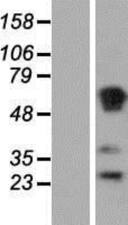 Novus Biologicals™ RASSF1 Overexpression Lysate