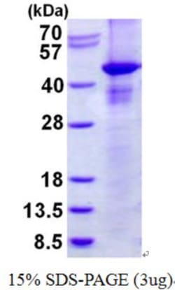 Novus Biologicals&trade;&nbsp;Recombinant Human RASSF1 His Protein