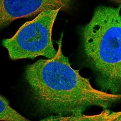 RASSF1 Antibody, Novus Biologicals 25 &mu;L | Buy Online | Novus Biologicals | Fisher Scientific