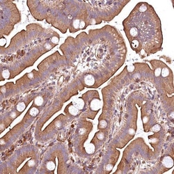 RASSF1 Antibody, Novus Biologicals 25 &mu;L | Buy Online | Novus Biologicals | Fisher Scientific