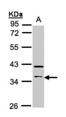 RASSF2 Antibody, Novus Biologicals 0.1 mL | Buy Online | Novus Biologicals | Fisher Scientific