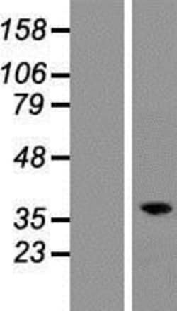 Novus Biologicals&trade;&nbsp;RASSF2 Overexpression Lysate