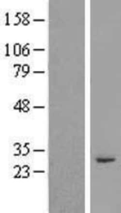 Novus Biologicals™ RASSF3 Overexpression Lysate