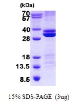 Novus Biologicals&trade;&nbsp;Recombinant Human RASSF3 His Protein