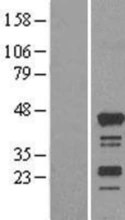Novus Biologicals&trade;&nbsp;RASSF4 Overexpression Lysate